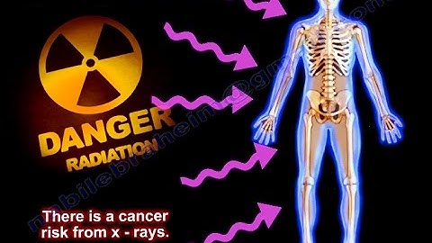 Radiation Exposure ,Radiation safety- Everything You Need To Know - Dr. Nabil Ebraheim