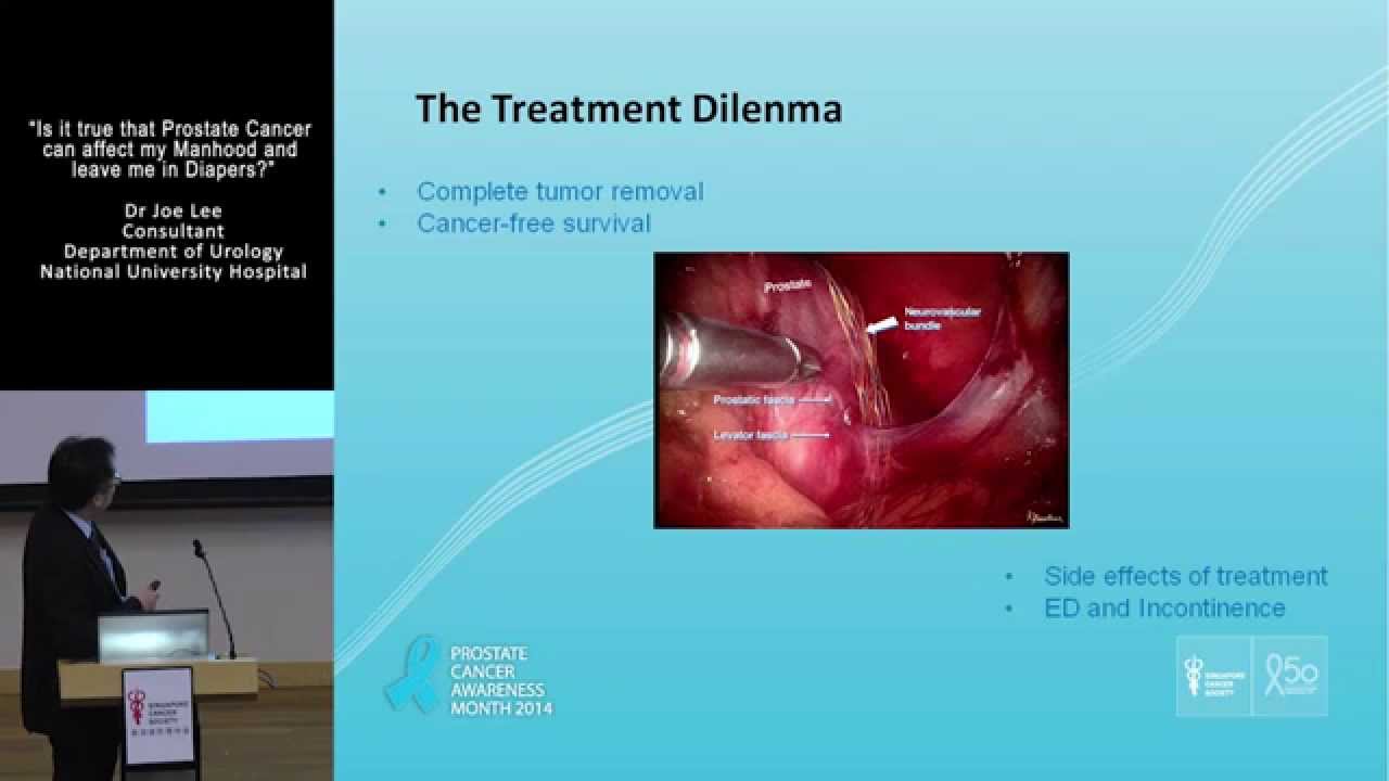 Will prostate cancer affect my manhood and leave me in diapers? Dr