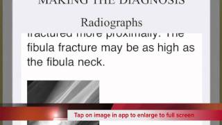 OrthoCare Medical App for iOS