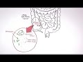 Hungry Microbiome: Starch Fermentation