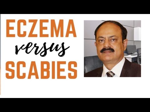 Scabies vs Eczema: Key Differences, Symptoms, and Effective Treatments