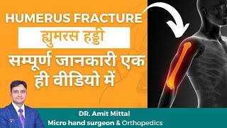Humerus Fracture in Hindi | Elbow Dislocation Treatment | shoulder fracture | Broken Upper Arm screenshot 3