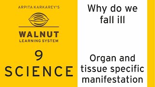 9 Science - Why do we fall ill - Organ and tissue specific manifestation