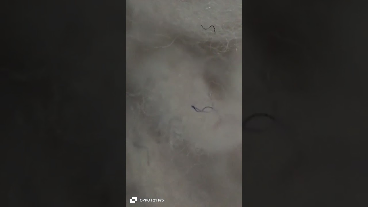 my blanket in microscope tell me what next 