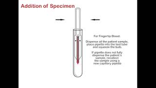 OSOM® MONO TEST  ENGLISH
