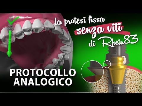 EASY FIX analog protocol