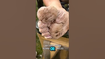 Incredible Feet Reveal After Race of 100 Miles 😲🫣 #shorts