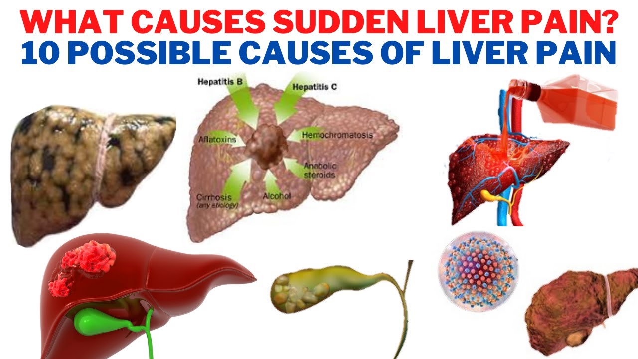 What causes sudden liver pain? - 10 Possible Causes of Liver Pain ...