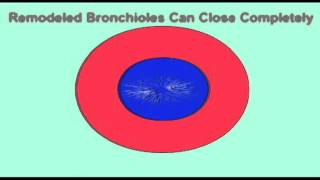 AP2 EXAM 2: BRONCHOCONSTRICTION & BRONCHODILATION.avi