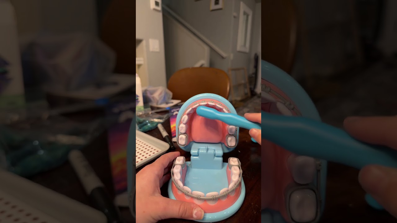 Last part day on the life of a dentist outing on braces