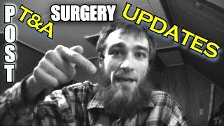 EXO Life UPDATE: Post Op Tonsillectomy / Adenoid Surgery VLOG - DAY 12 Recovery