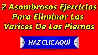 3 Asombrosos Ejercicios Para Eliminar Las Varices De Las Piernas(3 Asombrosos Ejercicios Para Eliminar Las Varices De Las Piernas → http://goo.gl/F09CoQ ← Para mí fue de gran alivio descubrir que existían remedios ..., 2015-10-14T19:00:01.000Z)