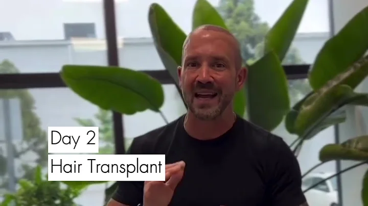 Most Advanced Virginia Beach Hair Transplant | Salt Spa & Wellness Center