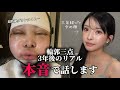 輪郭三点から三年経った私が良いことも悪いことも本音で話します