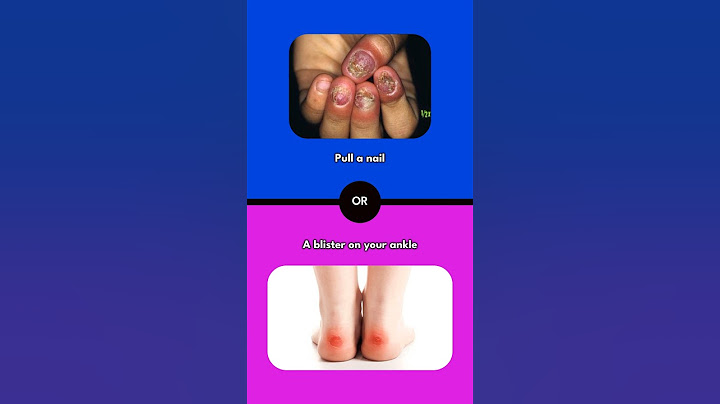 Would You Rather? (Hardest Choice Edition)
