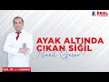 Ayak altında çıkan siğil nasıl geçer?