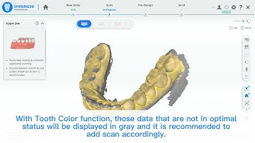 Aoralscan - Tooth color function