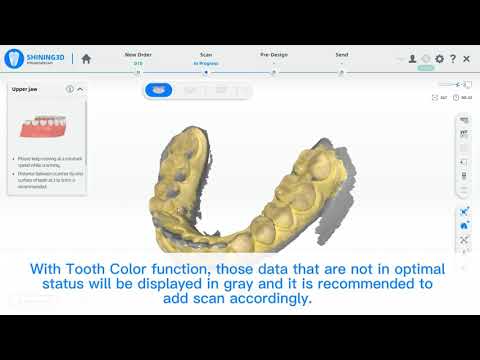 Aoralscan - Tooth color function