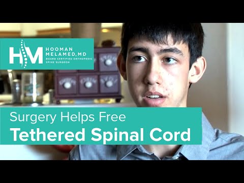 The Doctors — Tethered Spinal Cord Freed by Surgery