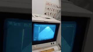 La dolce Barboncina Zoe e i cuccioli in arrivo