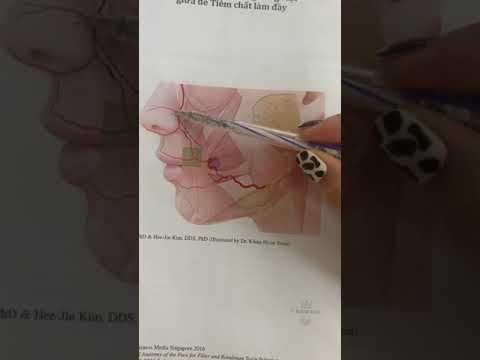 Học tiêm Filler & botox: Cách tiêm filler rãnh cười tránh mạch máu. - youtube