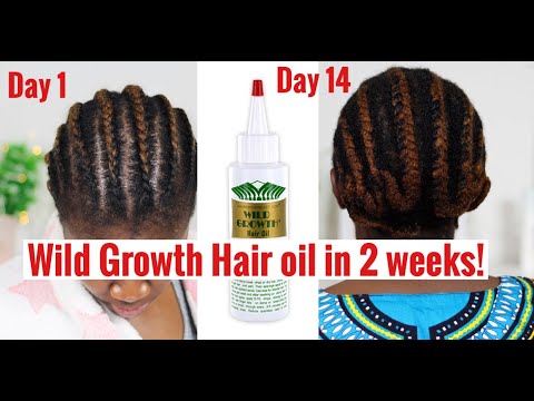 HOW TO USE WILD GROWTH HAIR OIL FOR MASSIVE HAIR GROWTH 2020 | Naturally  unbothered - thptnganamst.edu.vn