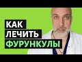 Как лечить фурункулы в домашних условиях (чирий) - Доктор Елизаров