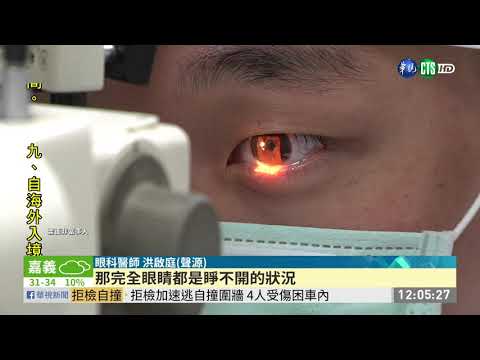 海邊玩水受光害 男大生眼痛險失明 | 華視新聞 20200713