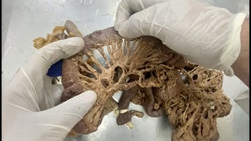 Anatomy of the Intestines - Small & Large Intestines (Cadaveric Dissection Video)