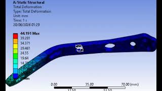 CAD Design &amp; FEA Simulation of Tibial Shin Bone Shaft/Diaphyseal Fractures Plate: SOlidworks Ansys