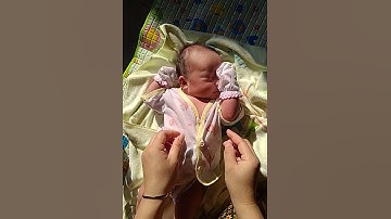 bayi baru lahir harus d jemur biar tidak kuning #shots