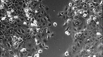 Time lapse video imaging of scratch healing assay