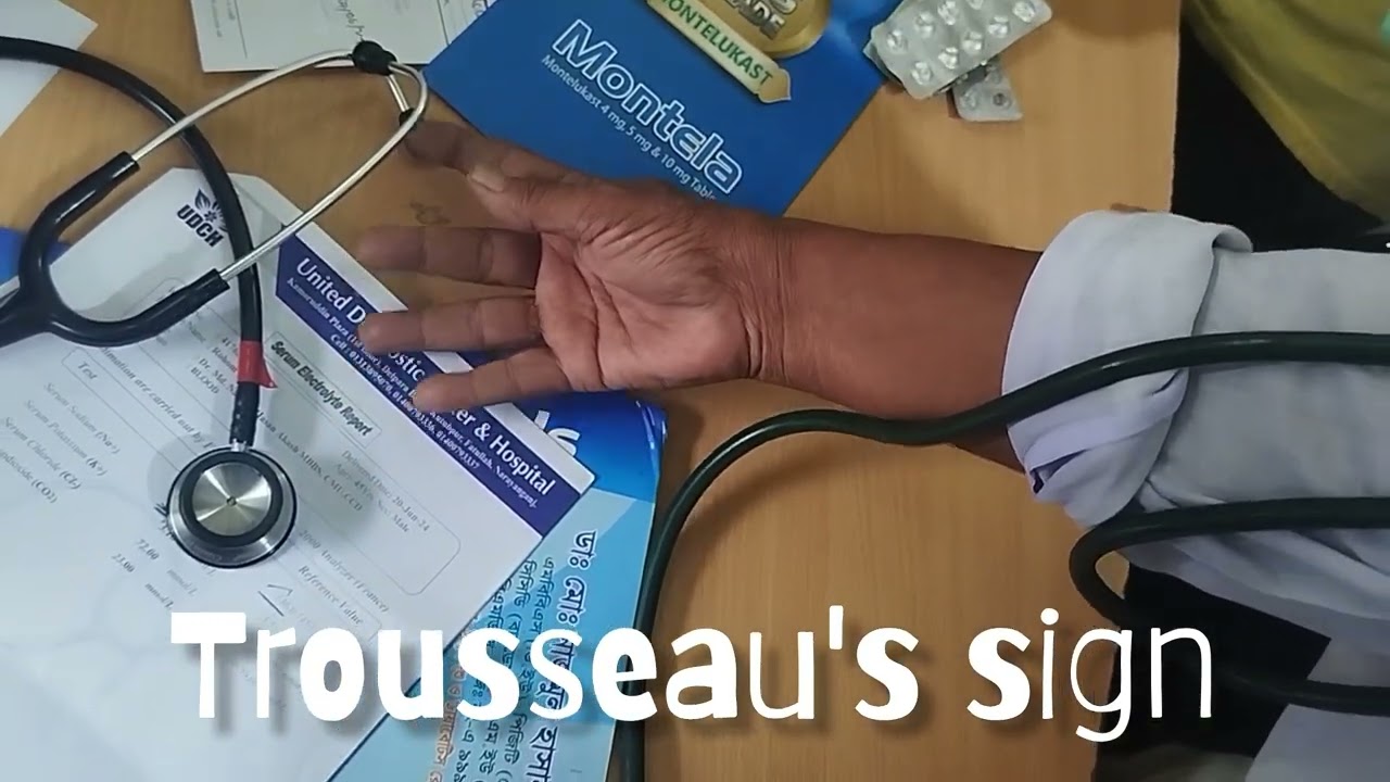 Trousseau's sign