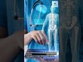 AI Driven Remote Patient Monitoring and Care | #shorts #futureedgevision #aifacts
