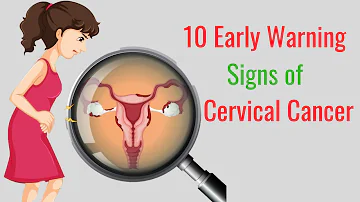 10 Early Warning Signs of Cervical Cancer You Should Not Ignore