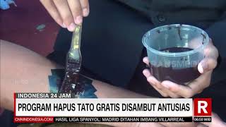 Download Lagu Program Hapus Tato Gratis Disambut Antusias | REDAKSI PAGI (26/09/21) MP3