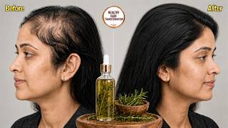I DROPPED THIS ON MY ROOTS AND MY HAIR GREW LIKE WEEDS! | Upgraded Rosemary Water Kaise Banaye