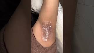 Armpit Waxing -Underarms Whitening Wax With Transparent Gel