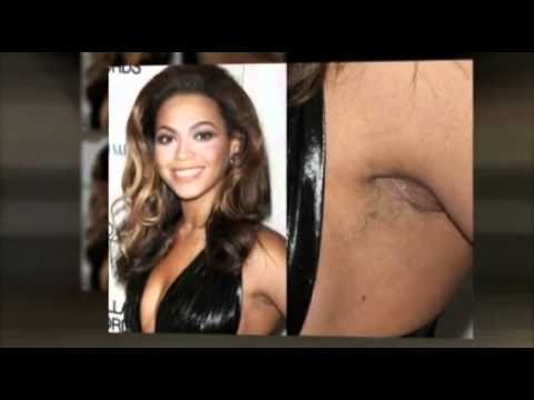 Underarm Whitening - Even Beyonce ! All Women Find This 