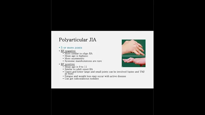 Juvenile Idiopathic Arthritis: Pointers for the Primary Care Practitioner