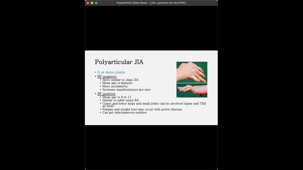 Juvenile Idiopathic Arthritis: Pointers for the Primary Care Practitioner
