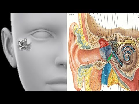 Vidéo: Conception Par IRM D'applicateurs De Curiethérapie Gynécologiques Personnalisés Imprimés En 3D Avec Canaux D'aiguille Incurvés