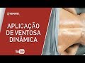 Aplicação de Ventosa dinâmica nos eretores e quadrado lombar
