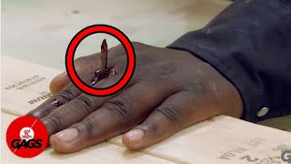 Horrible Work Accident | Just For Laughs Gags Compilation