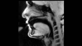 Douglas Yeo, trombone - MRI video 7 - air attacks 1