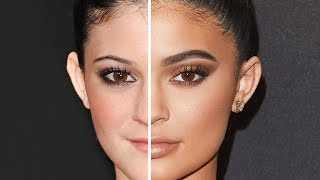 KYLIE JENNER: Before and After Plastic Surgery