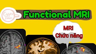 Functional MRI ( Mri chức năng)