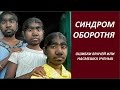 Синдром оборотня  № 2804