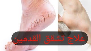 وداعا تشققات القدم 🥰 screenshot 2