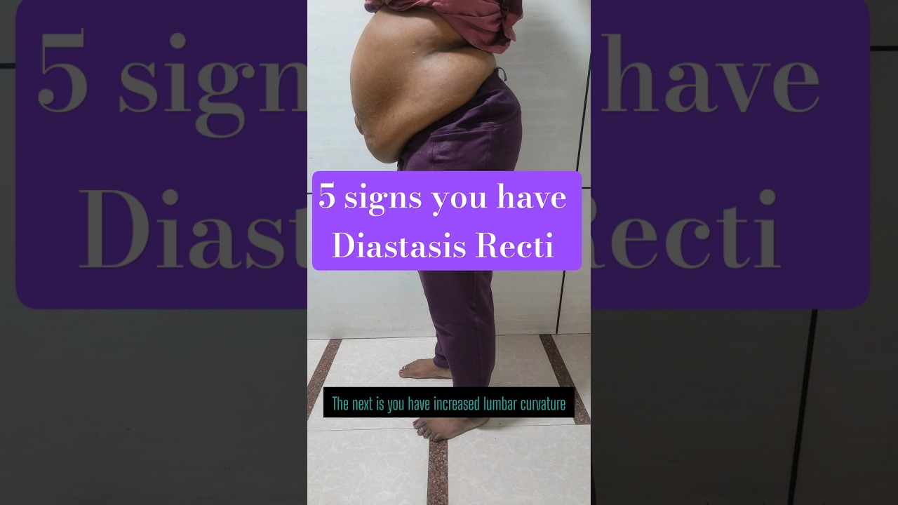 5 signs of Diastasis Recti by Pooja Pandey Tripathi #diastasisrecti